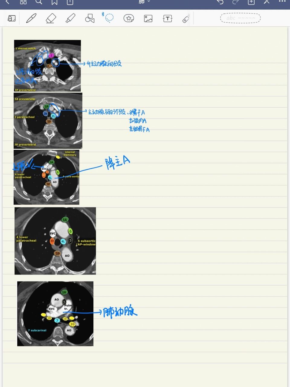 纵隔淋巴结分组图图片