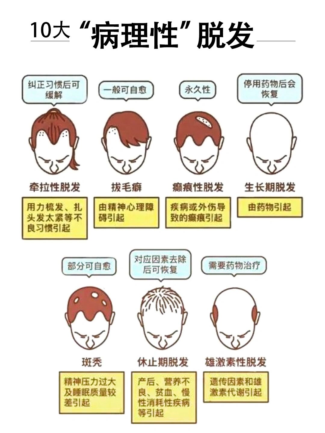 1156601566大病理性脱发97快看你有没有 01雄性激素原脱发