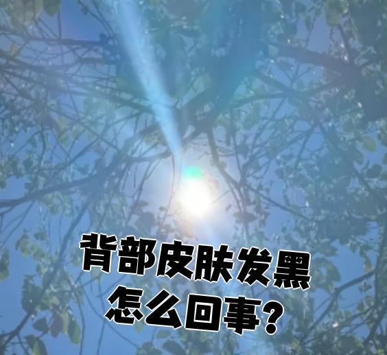 狗狗皮肤为什么会变黑为什么在线 狗狗皮肤为什么会变黑为什么在线