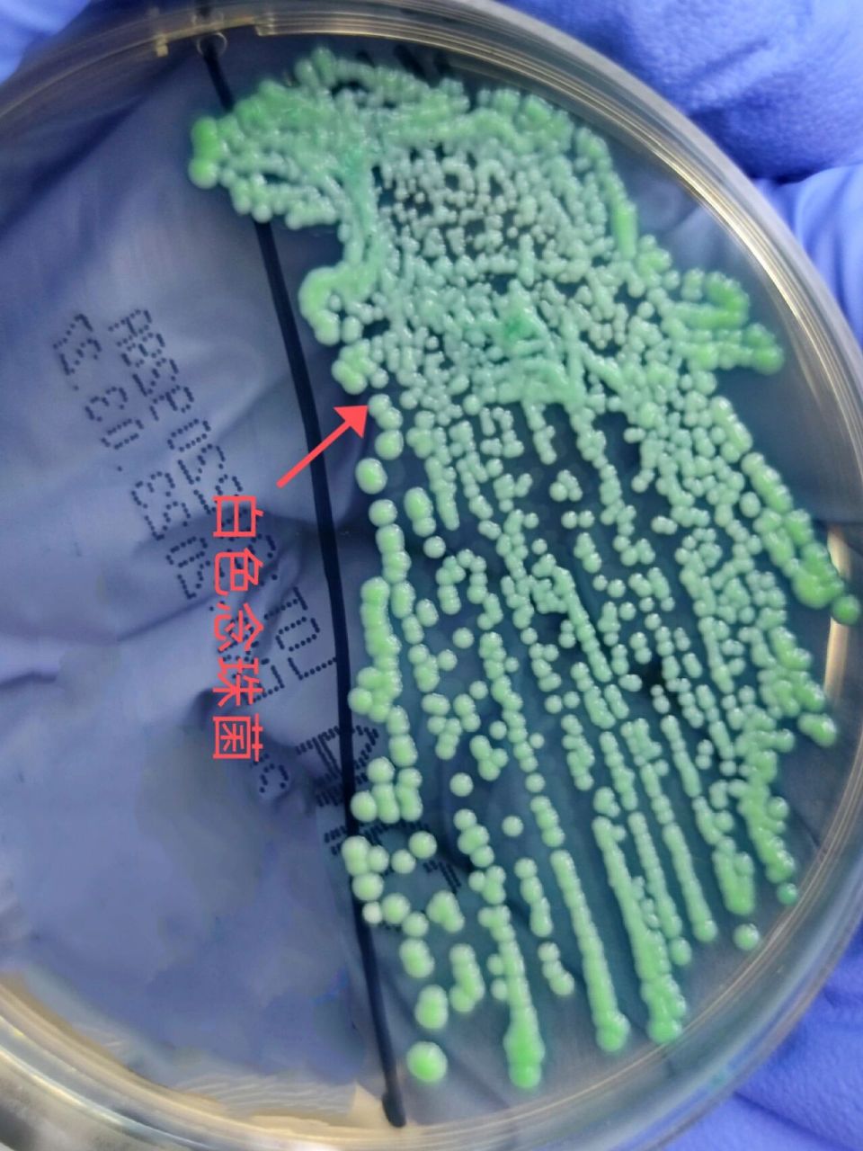 微生物之《白色念珠菌》     白色念珠菌:生长茂盛,菌落光滑.