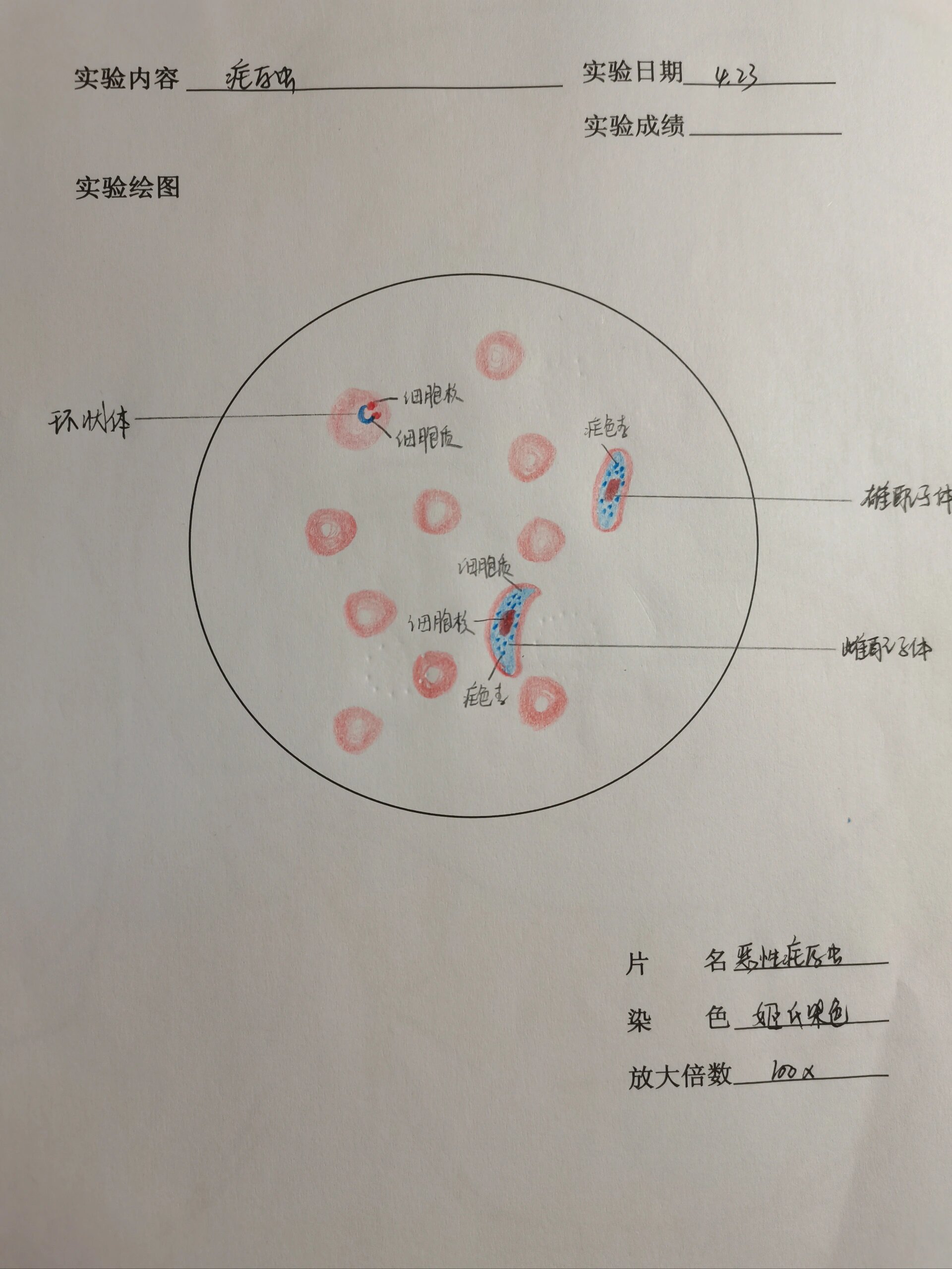 疟原虫小滋养体手绘图图片