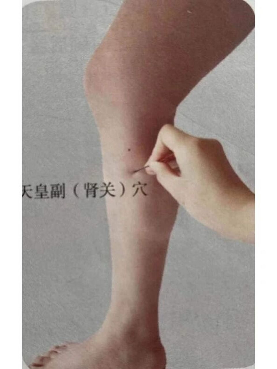 肾关穴 肾关通常是指肾关穴,是董氏针灸的穴位.具体定位在阴陵泉下1.