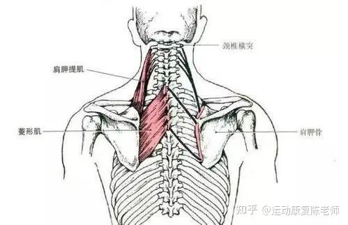 菱形肌筋膜炎图片