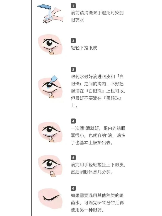 眼药水的正确使用方法及步骤