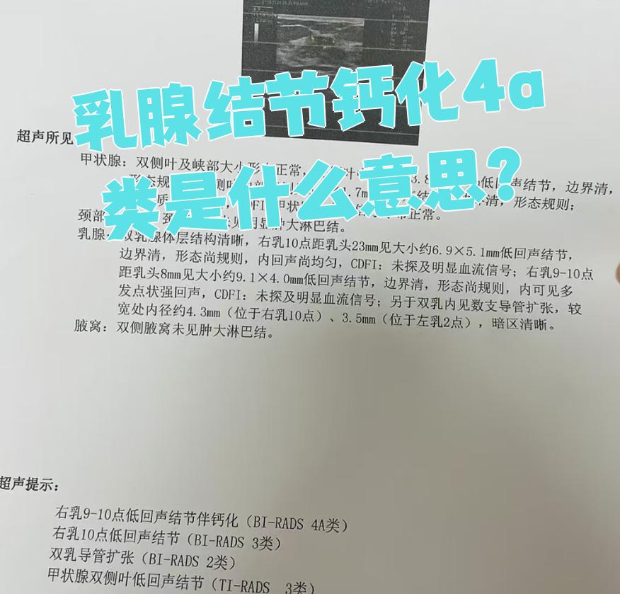 乳腺结节钙化4a类是指通过影像检查发现结节存在钙化,且被归类为4a