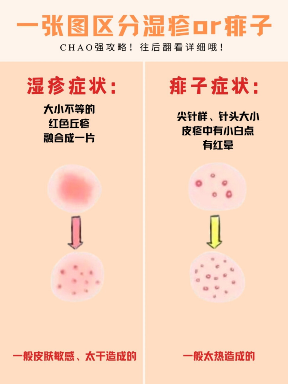 胎毒与湿疹的区别图图片