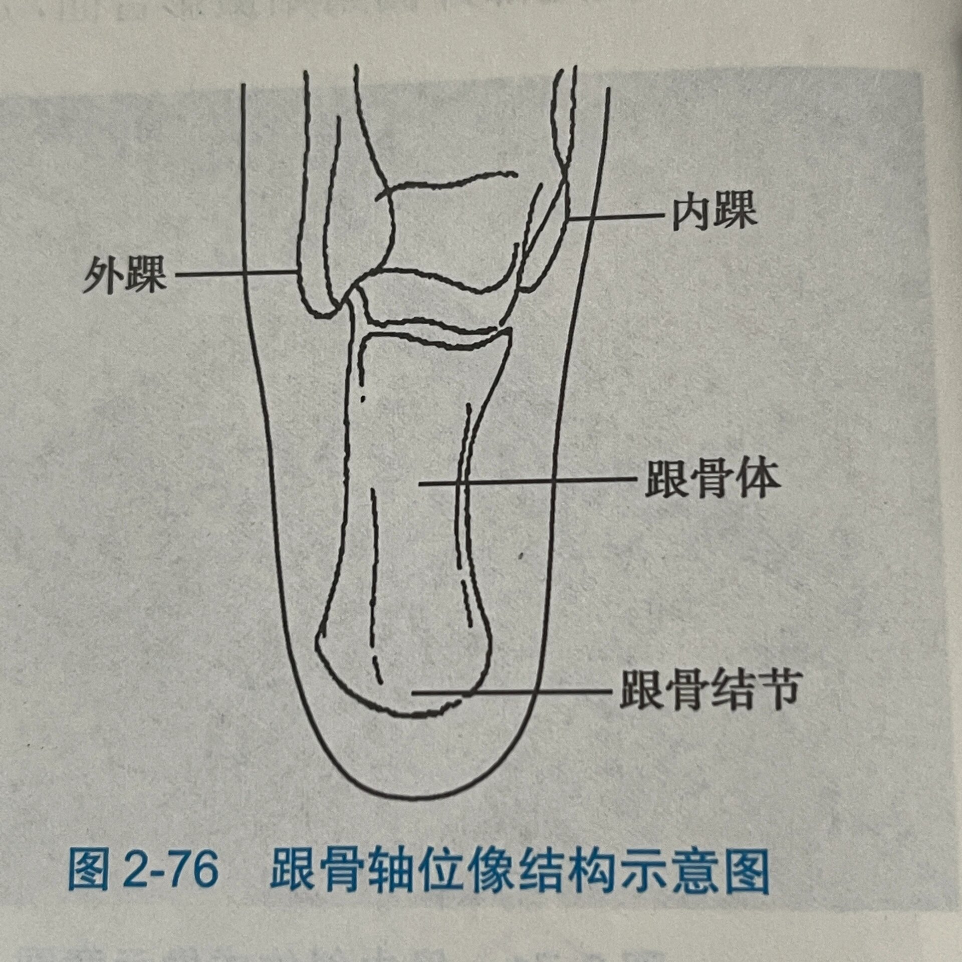 根骨轴位图片