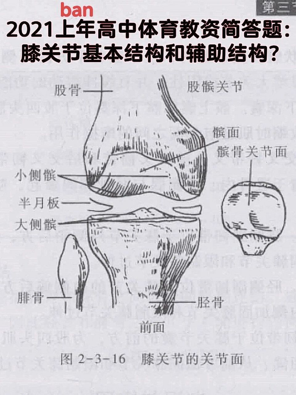 人体膝关节结构图高清图片