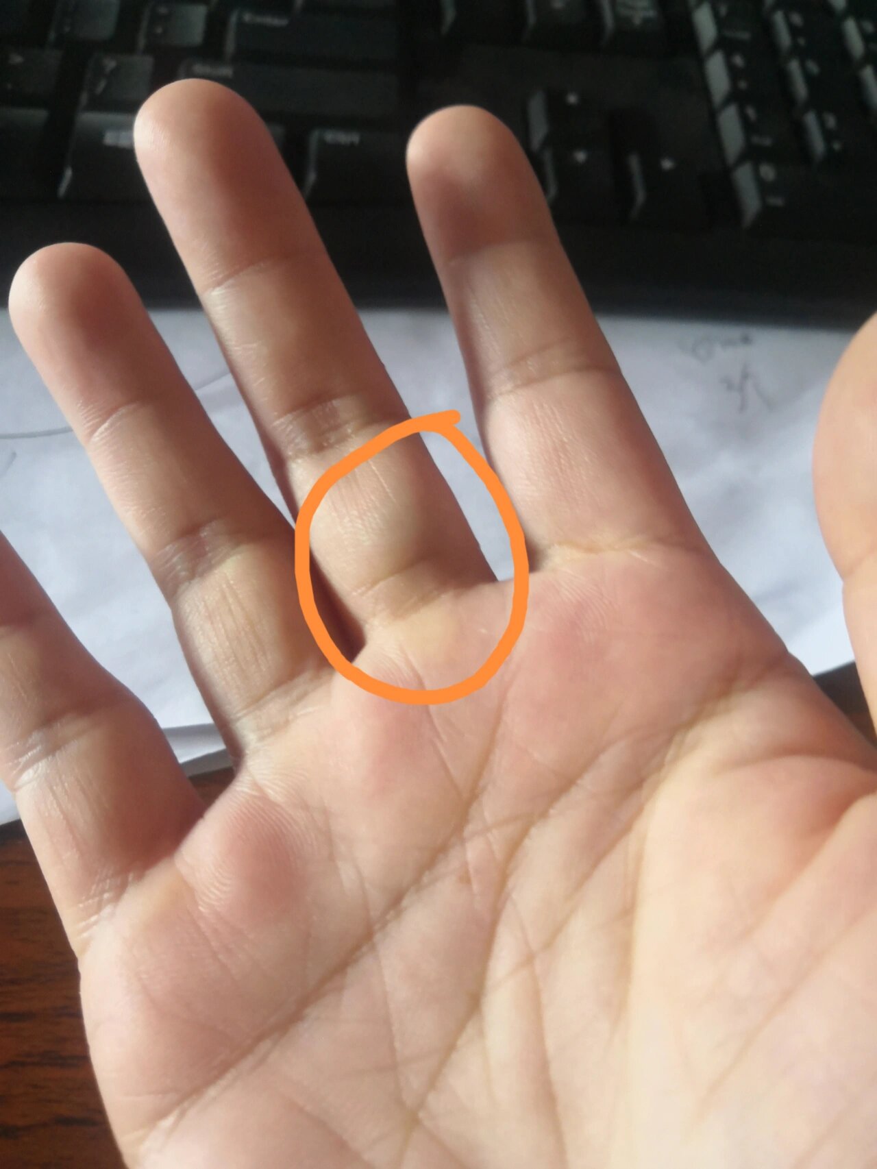 手指的这个位置,里面肿了,按着有一颗滑来滑去,外表看青色