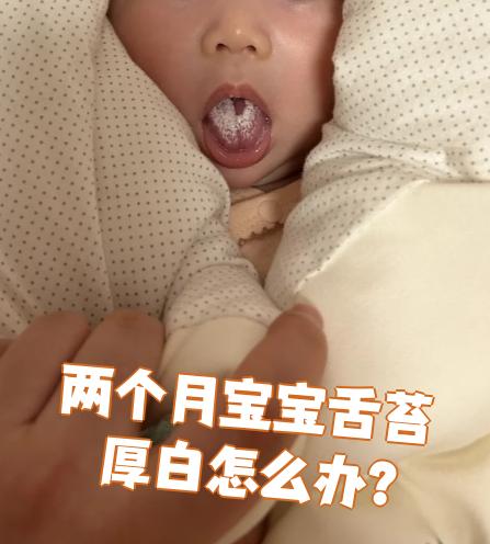 两个月宝宝舌苔厚白可能是正常现象,也可能是消化不良或鹅口疮引起