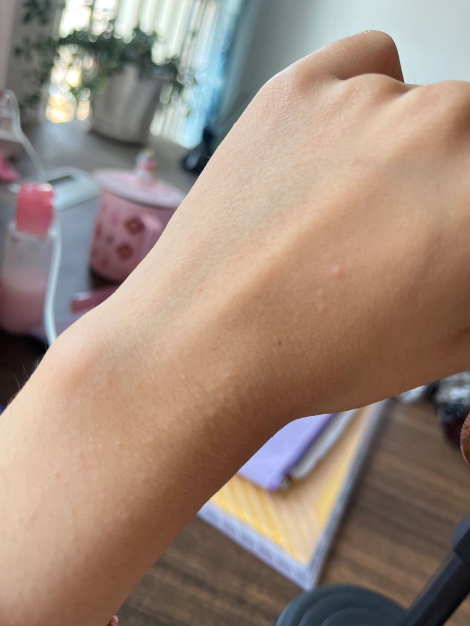 手上起了些小疙瘩 好像每年夏天都会这样 有点痒 知道这是怎么回事吗