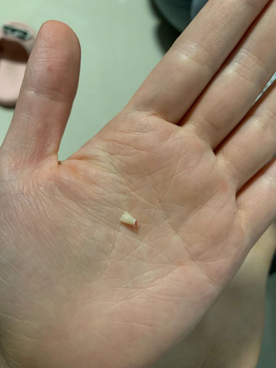 就在刚刚松动的乳牙掉了个,好奇乳牙没有牙根的吗?