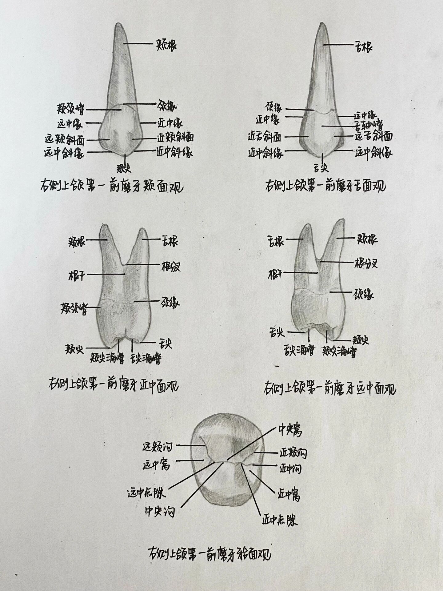 下颌中切牙缺失图片