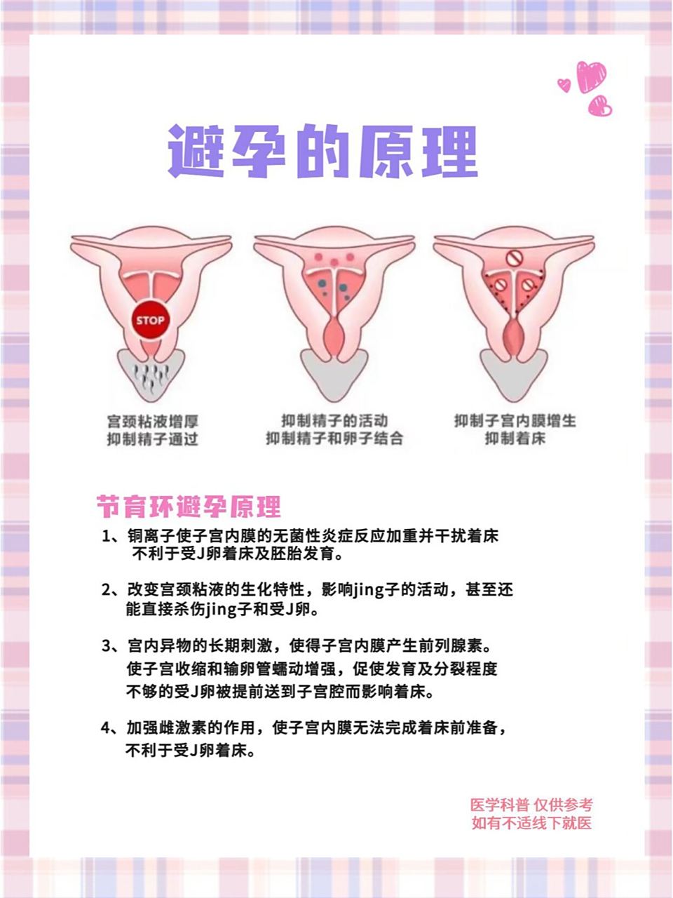 女性什么时候上环比较合适?