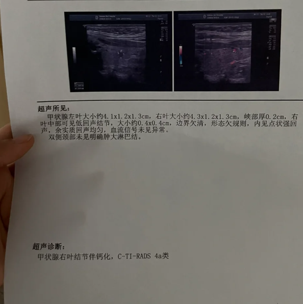 为什么医生不建议查颈部彩超 为什么医生不建议查颈部彩超