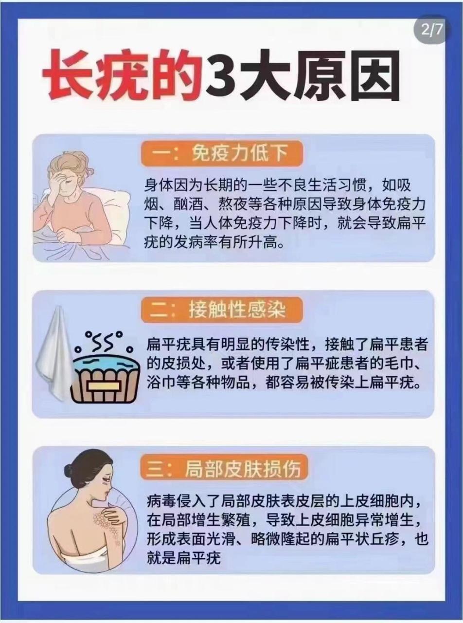 长疣的三大原因 长疣一定要去疣,一定为什么要去疣?