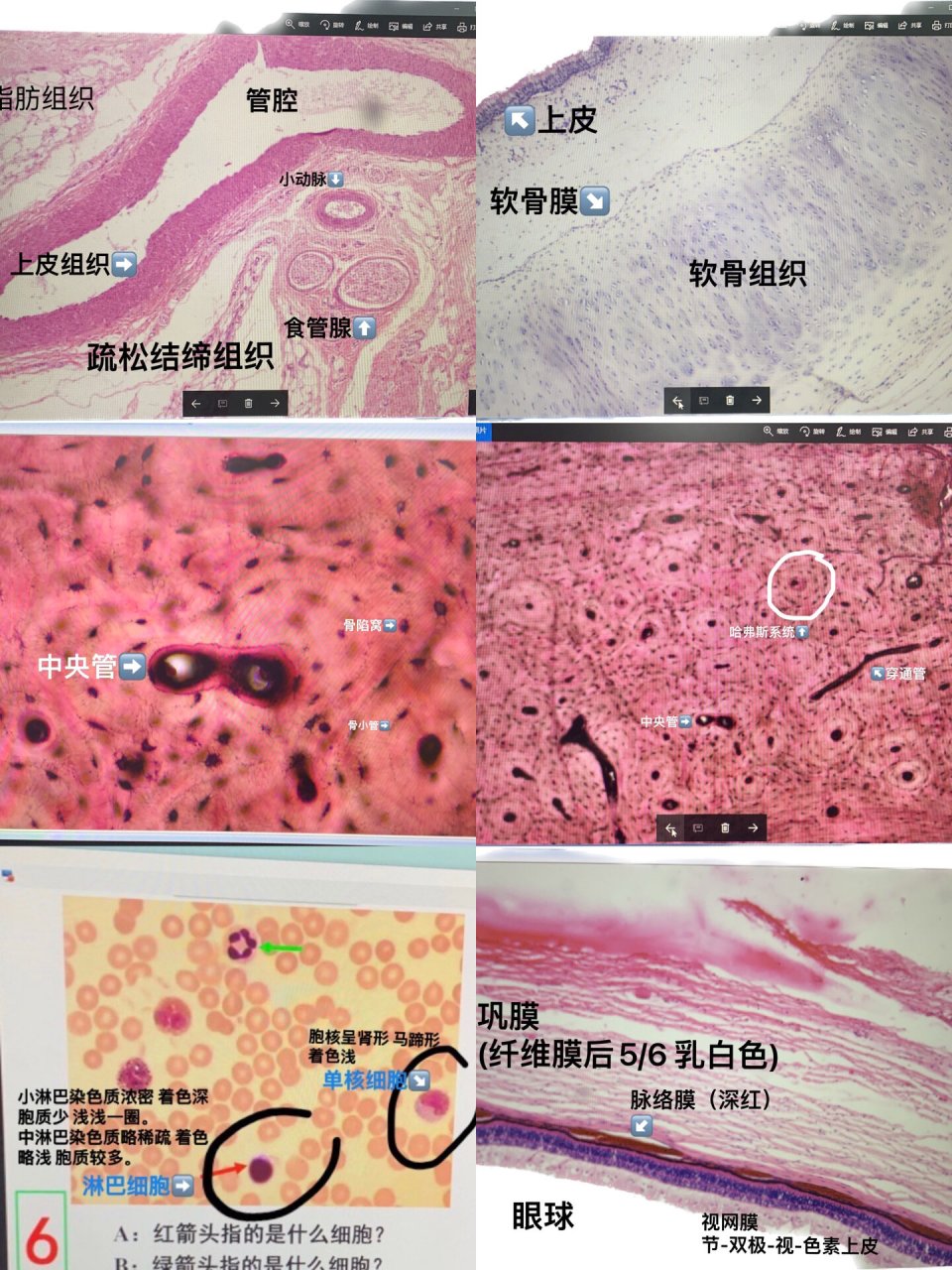 纤维环由透明软骨构成图片