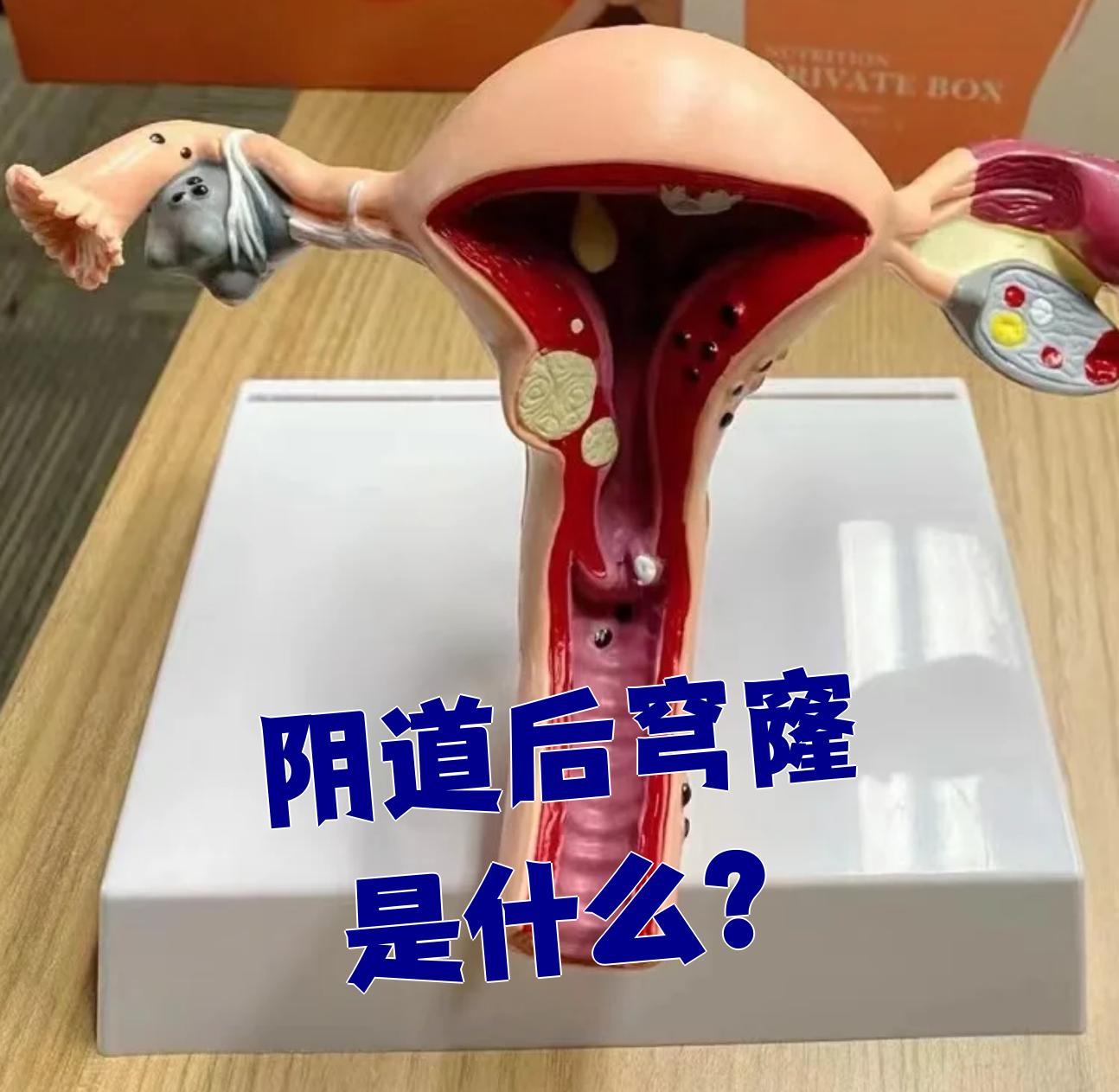阴道后穹窿是女性生殖系统的一个解剖位置,在阴道顶端,宫颈后方