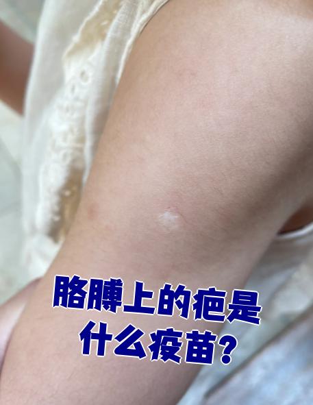 胳膊上的疤可能是牛痘疫苗或者卡介苗留下的