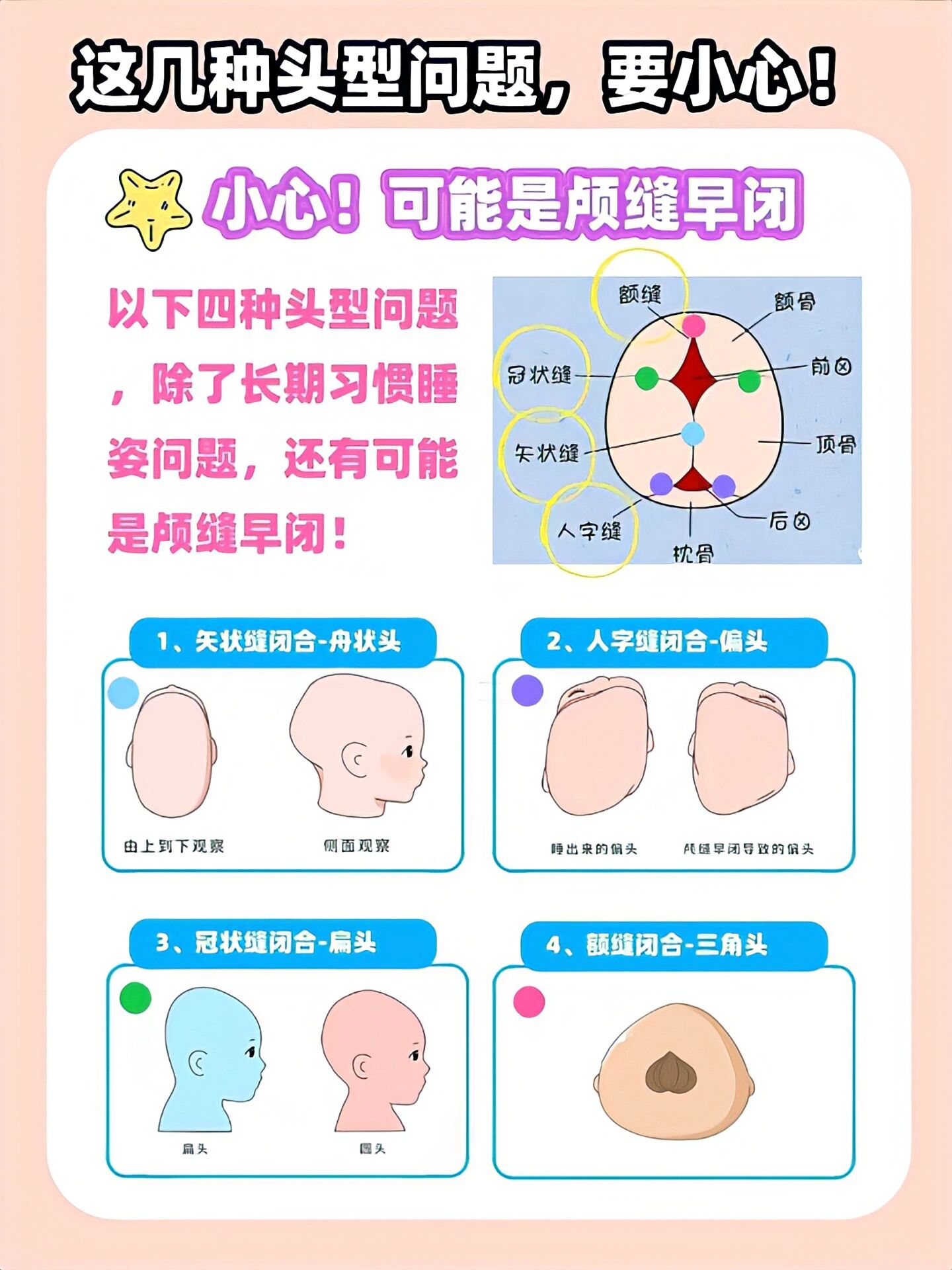 人字缝早闭图片图片