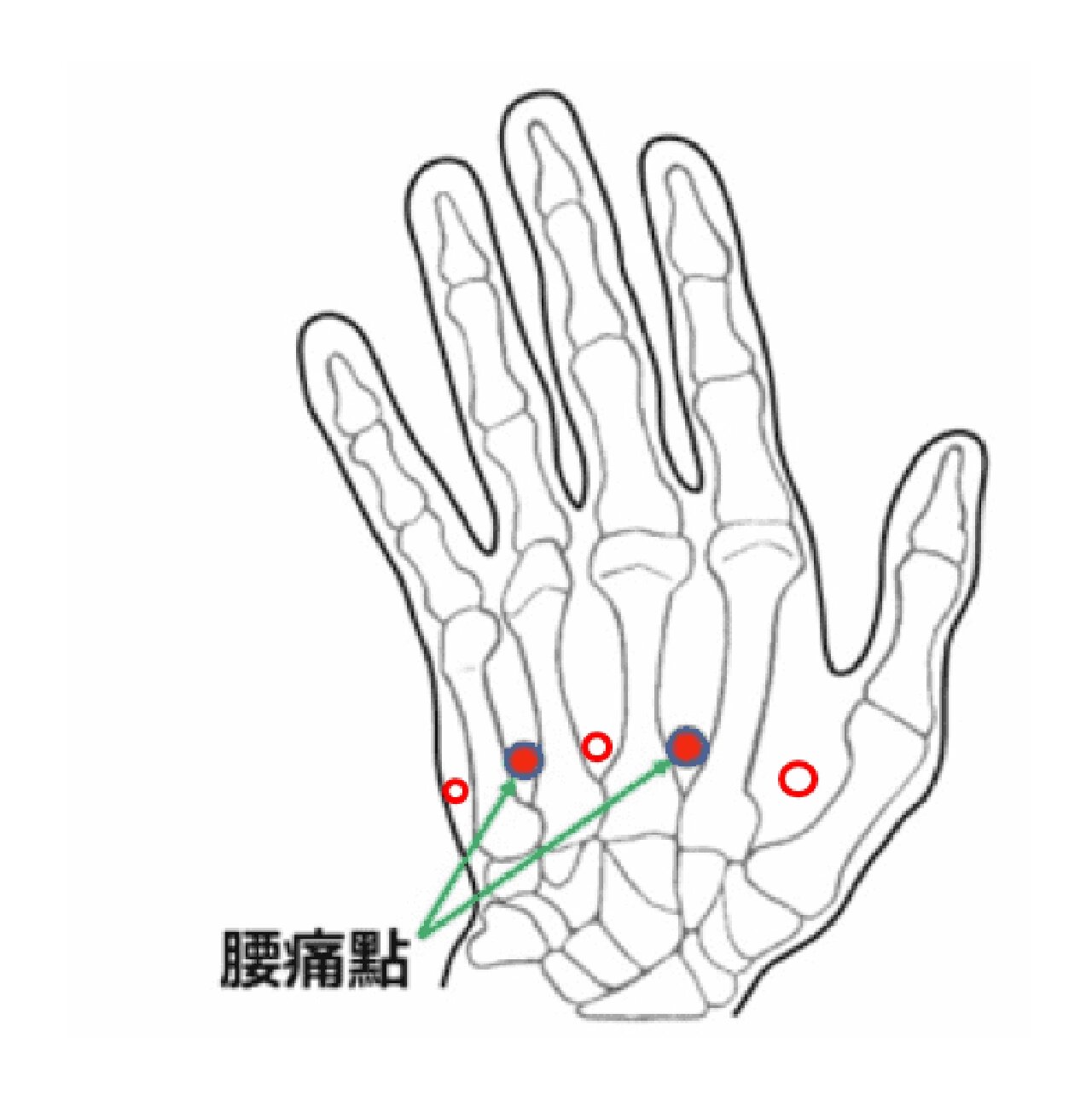 腰疼针灸什么部位图解图片