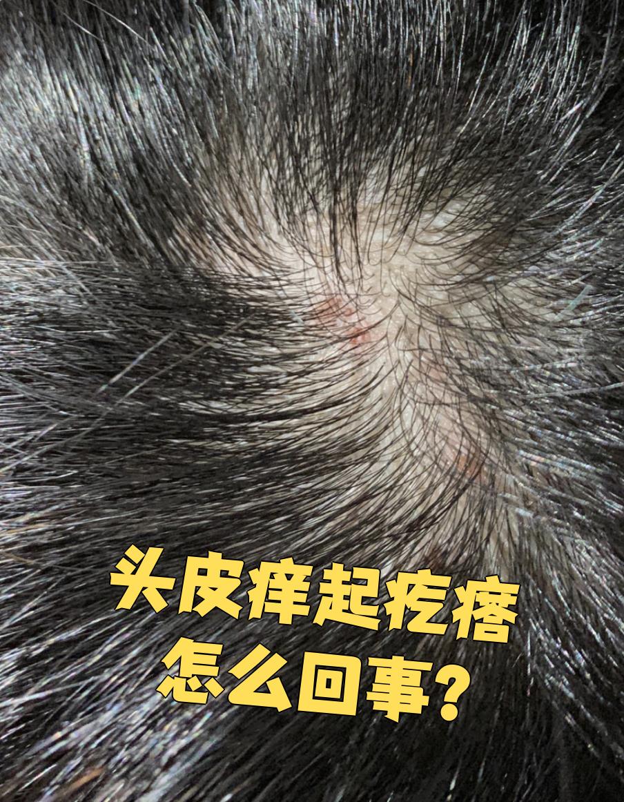 为什么头皮总是很痒还掉头发为什么在线