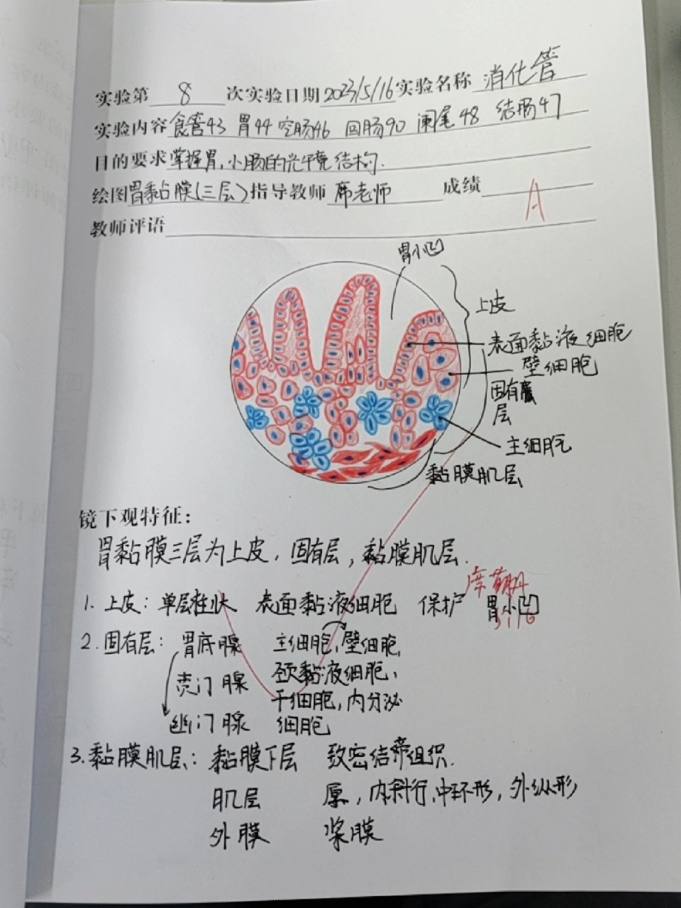 胃黏膜红蓝铅笔绘图