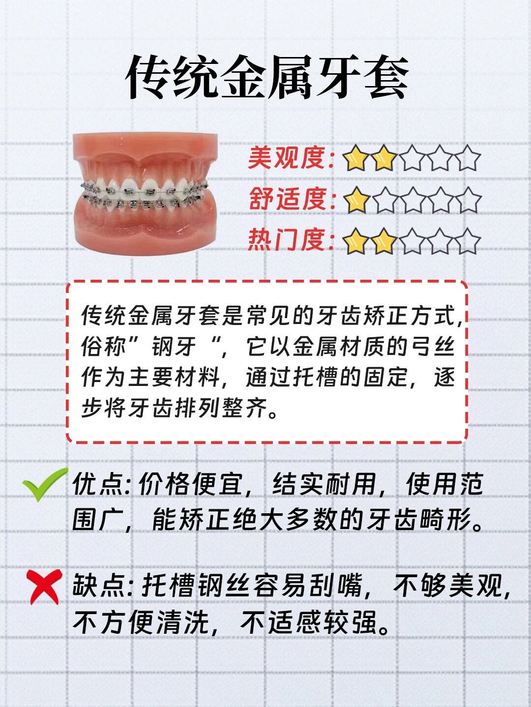 牙套有几种类型图片