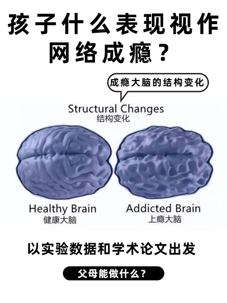 网瘾对大脑的影响!