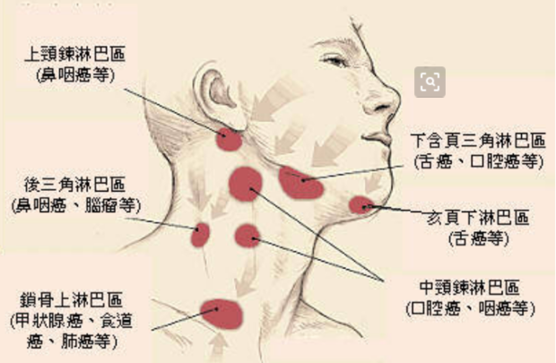 甲状腺淋巴位置图图片