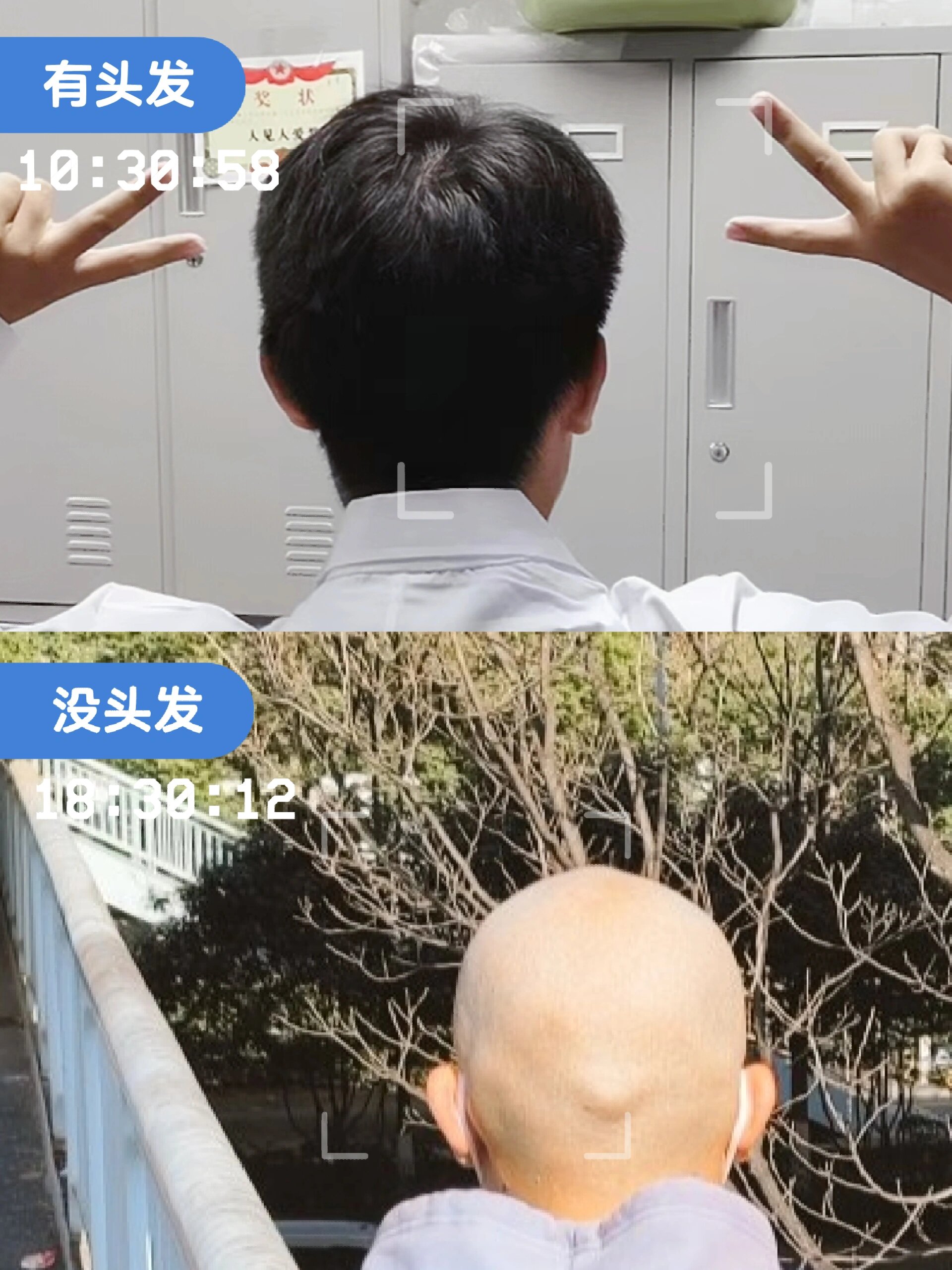 光头反差(后脑勺来了)