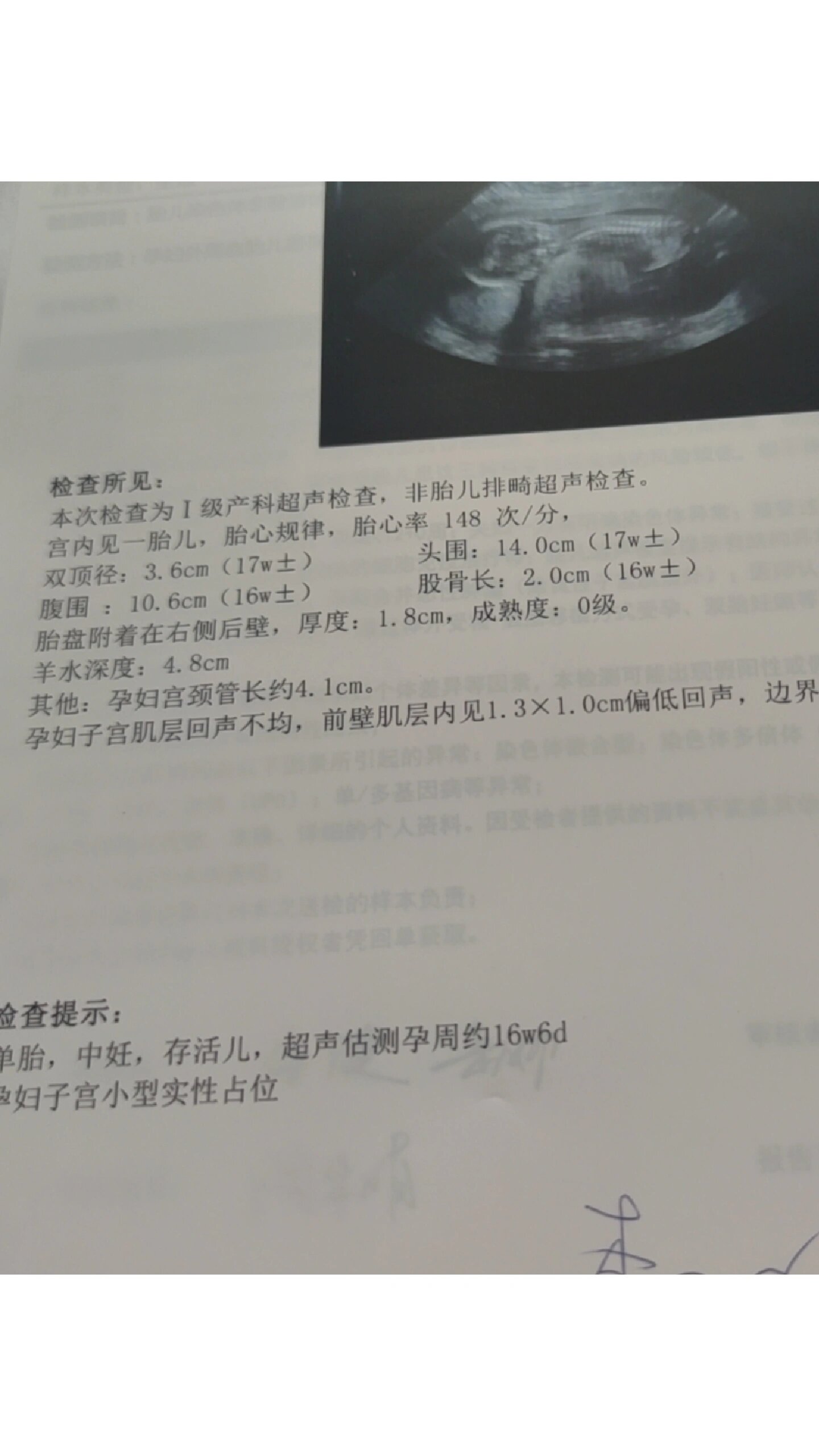 好像…成功了?14周单脐动脉17周双脐动脉了