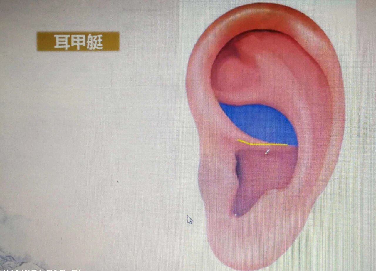 中医【耳穴定位】疗法:耳甲艇穴位分布展示