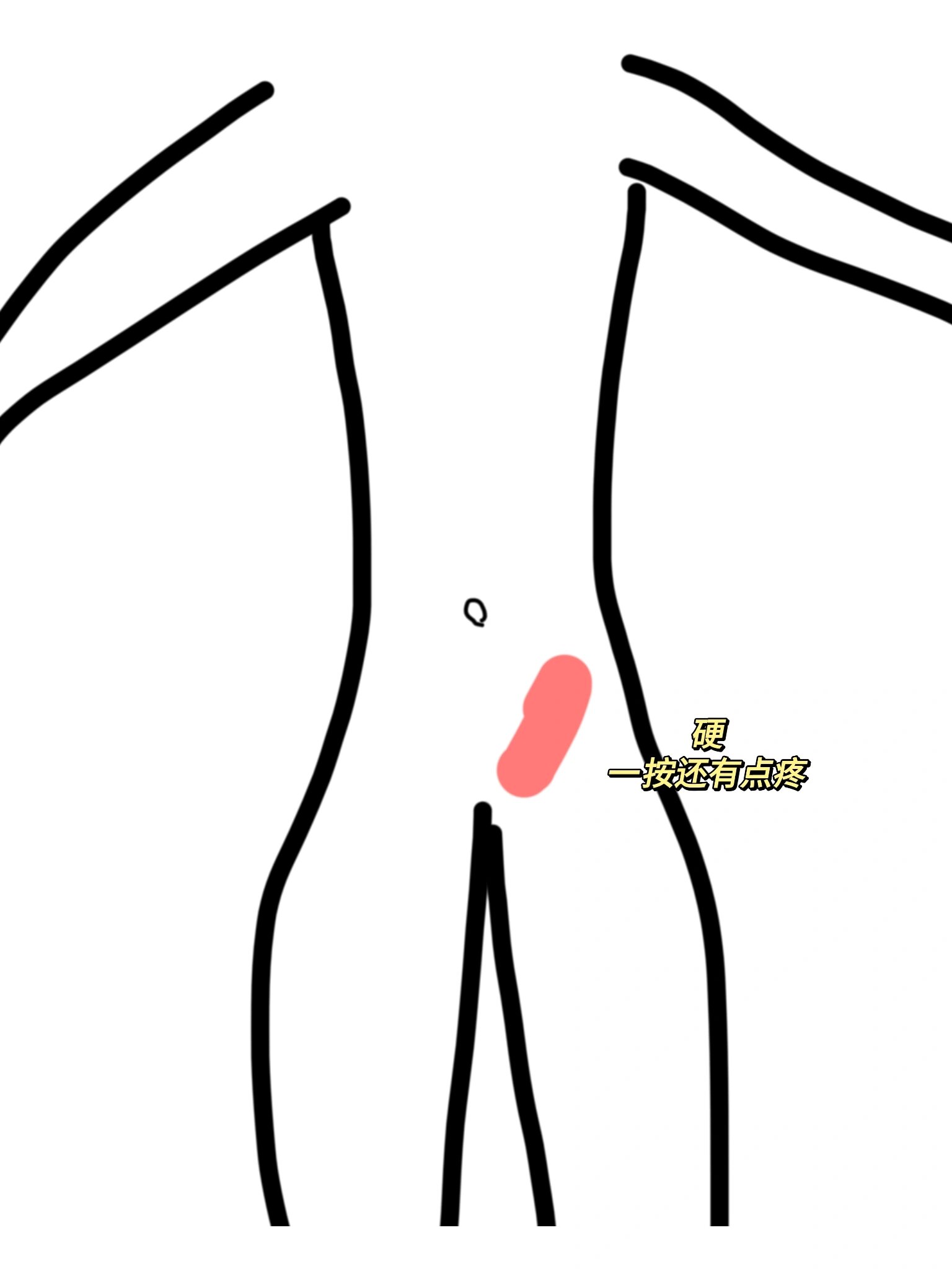 小腹左下方硬硬的一按还有点疼,吓到我了