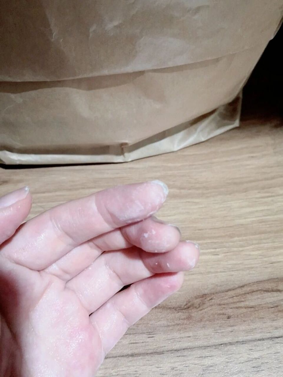 502胶水全粘手上啦 晚上本来是粘鞋子,结果不知怎么搞的,瓶口的胶水漏