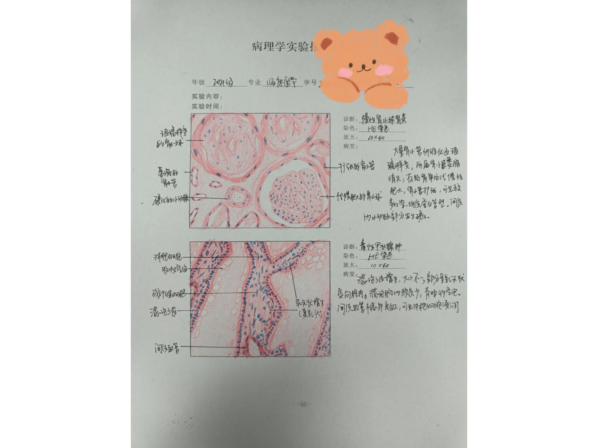 肾浊肿手绘实验报告图图片