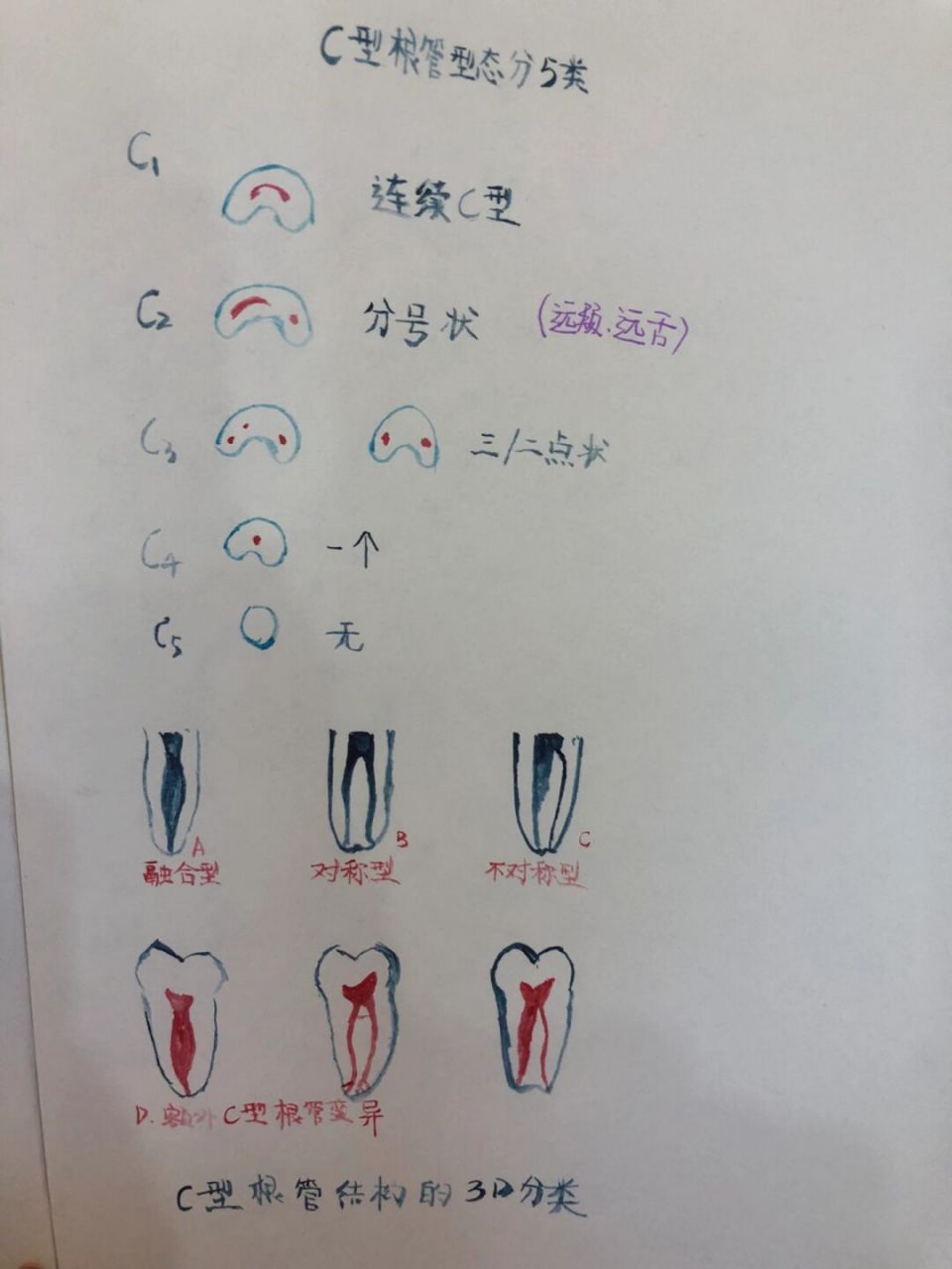 07喻刚# #c型根管的分类与治疗技巧# #牛牙症#(来这工作的第2周就