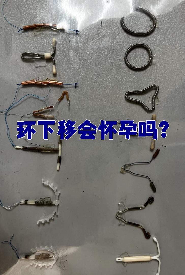 节育环下移确实可能引起怀孕