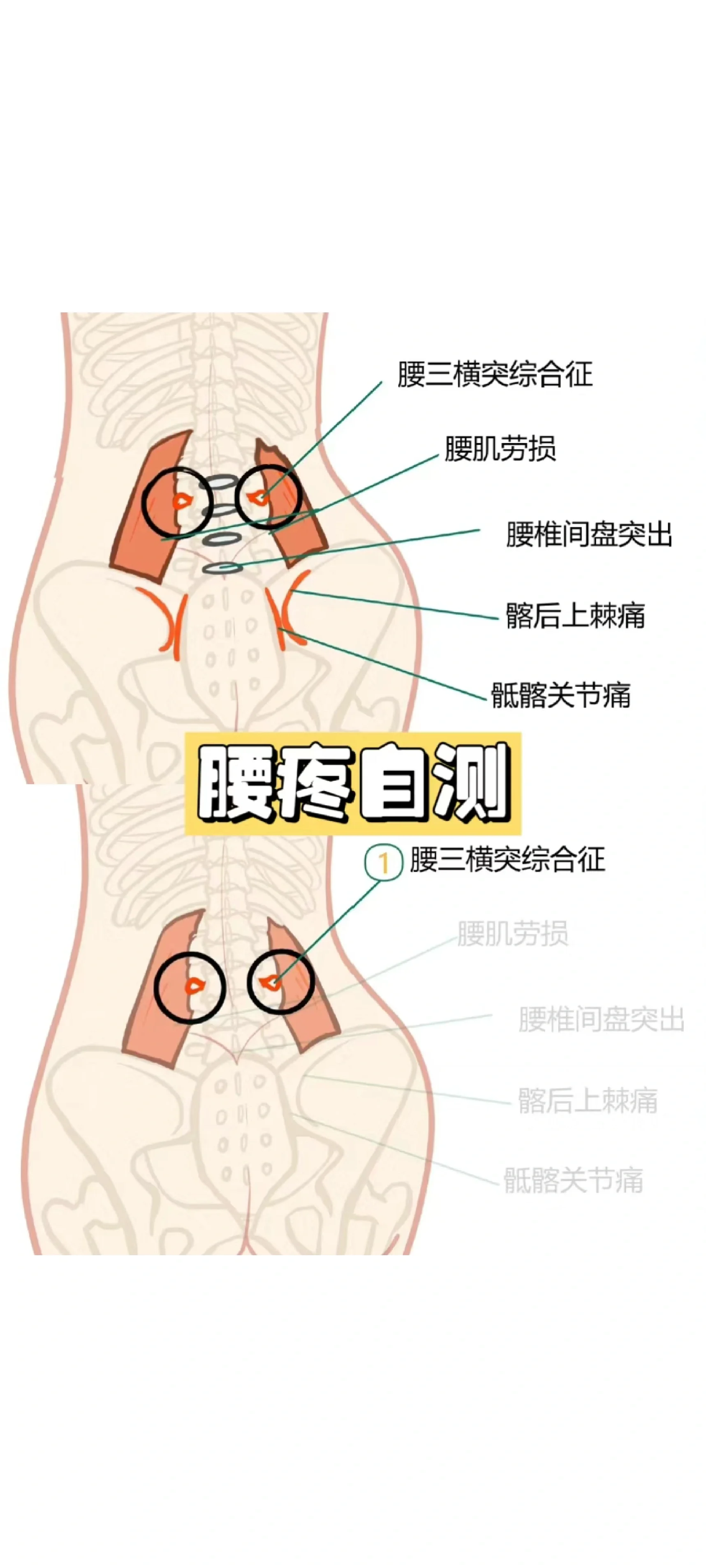 l3腰椎是什么位置图片图片