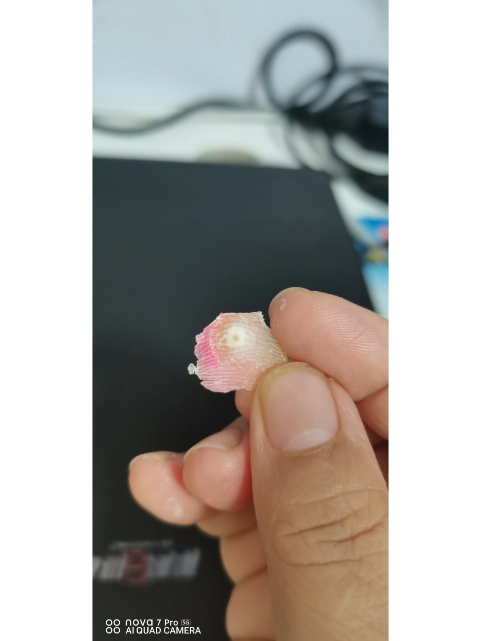 这就是鸡眼,根掉了就好了, 两盒鸡眼膏24元,每天坚持贴.