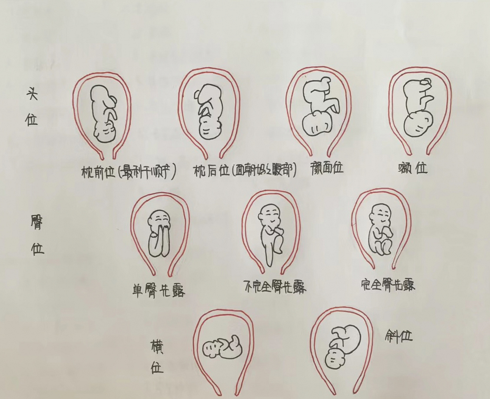 b超显示宝宝在里面横着趴着呢 这横着趴着是啥体位