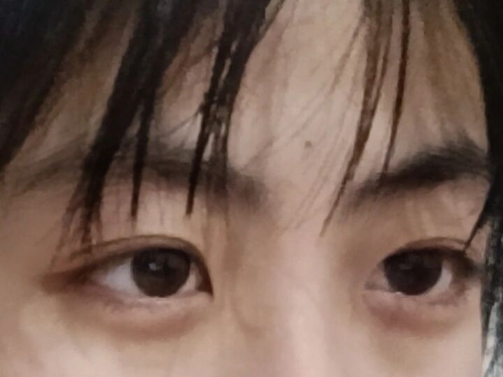 额头中间的黑点是什么东西,感觉也不像痣啊 小的时候比较淡,长大之后