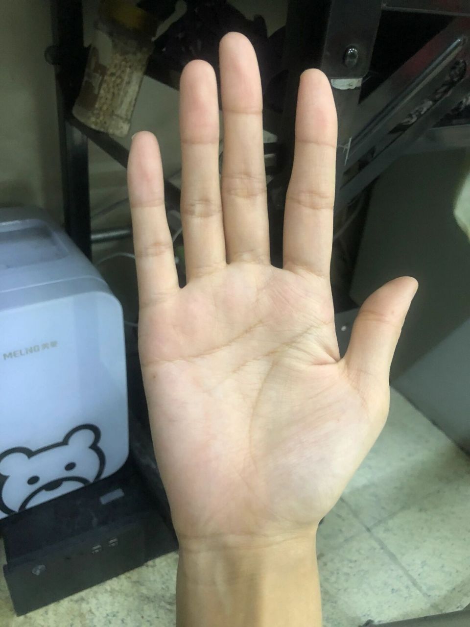 大鱼际发青是什么情况