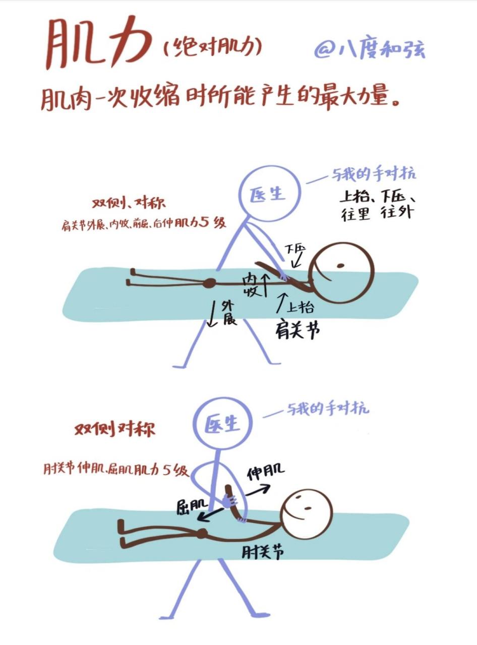 肌张力高判断图片图片