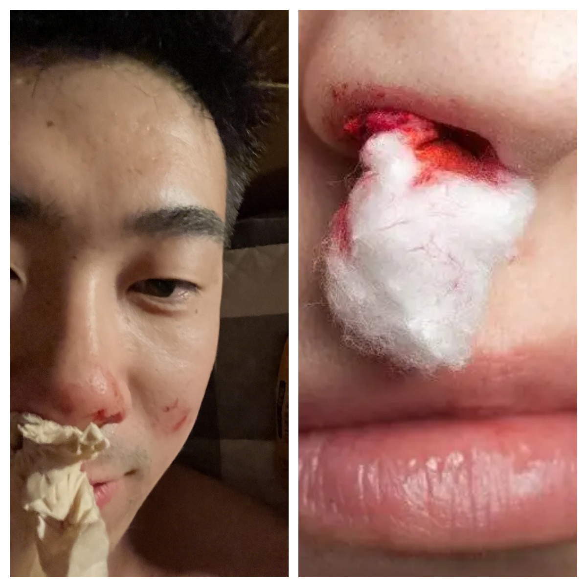 希望能找到原因,避免再次鼻血流鼻血男生流鼻血图片发朋友圈真实