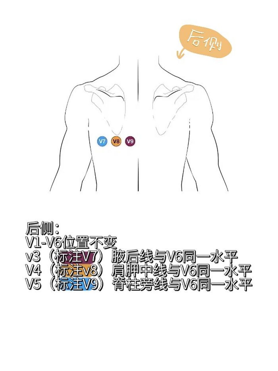 心电18导联的位置图片图片