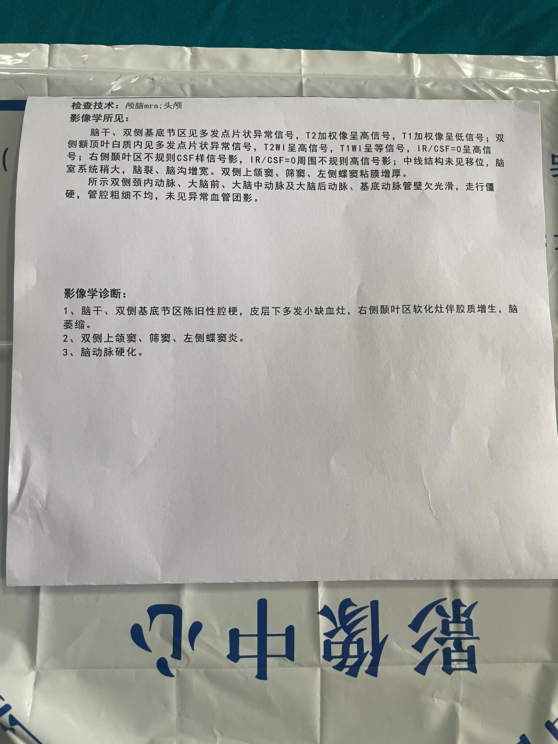 脑部核磁共振报告图片