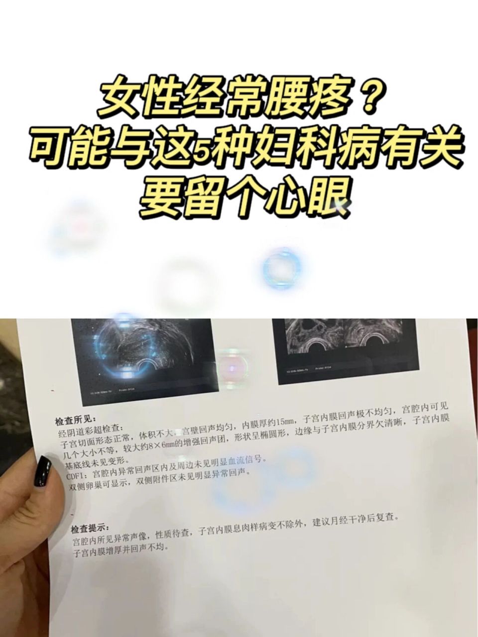 可能与这5种妇科病有关 腰痛是很多人都出现过的症状,但很少人人在
