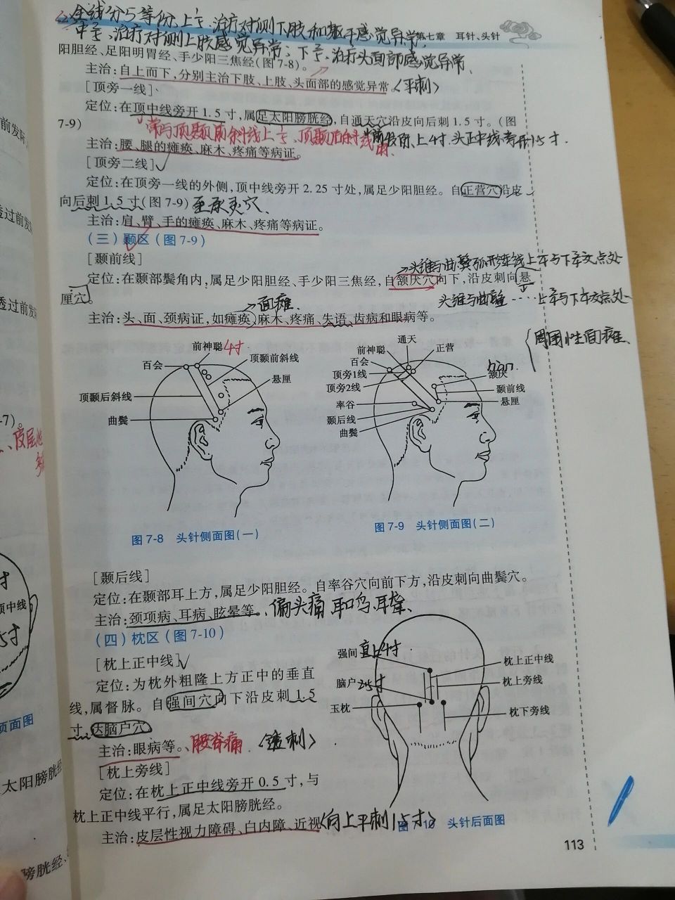 头针语言区图解图片