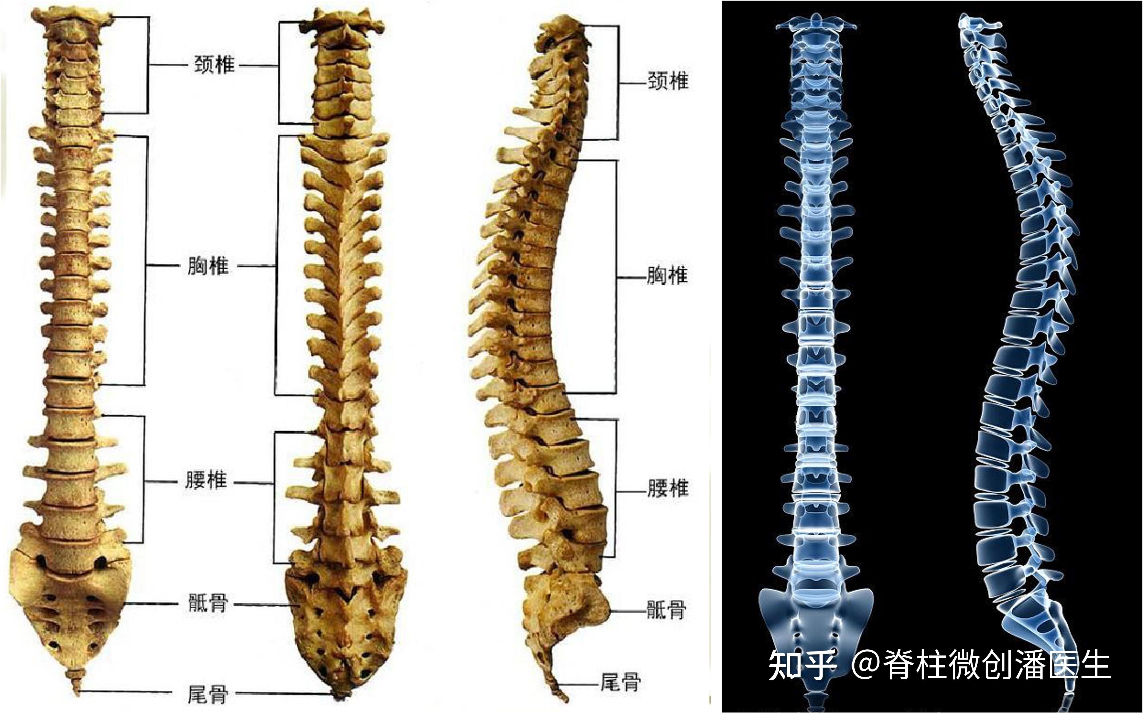 我是腰椎骶化或者骶椎腰化吗